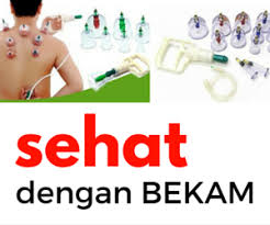 Bisnis